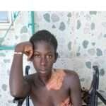 Jovem de 21 anos Sofre Queimaduras por Água Quente em Ingoré